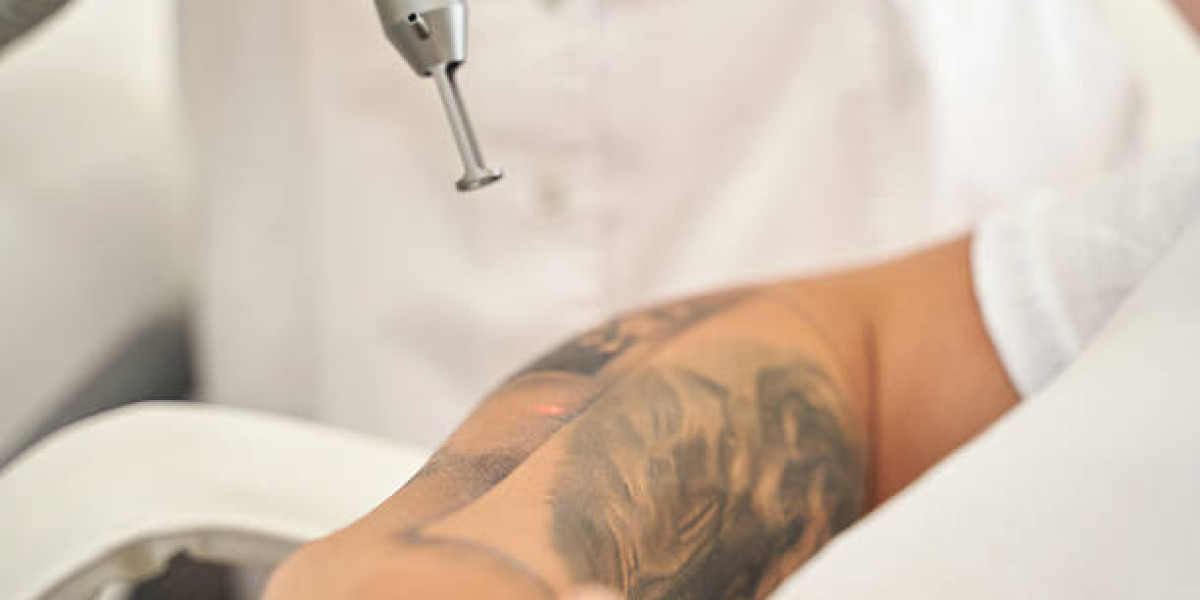 How Lifestyle Habits Can Influence Laser Tattoo Removal Recovery