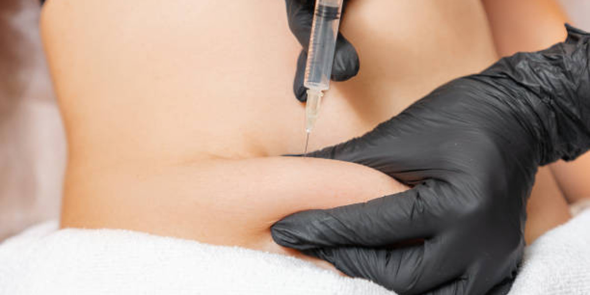 Customized Fat Reduction Treatments in Riyadh