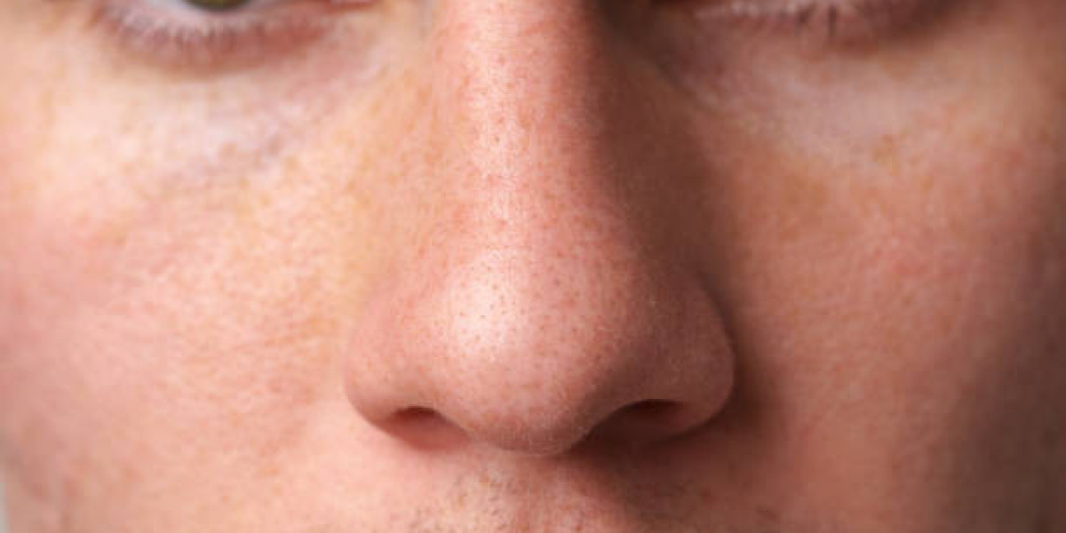 Best Alarplasty Surgeons in Riyadh: A Guide to Choosing the Right Specialist